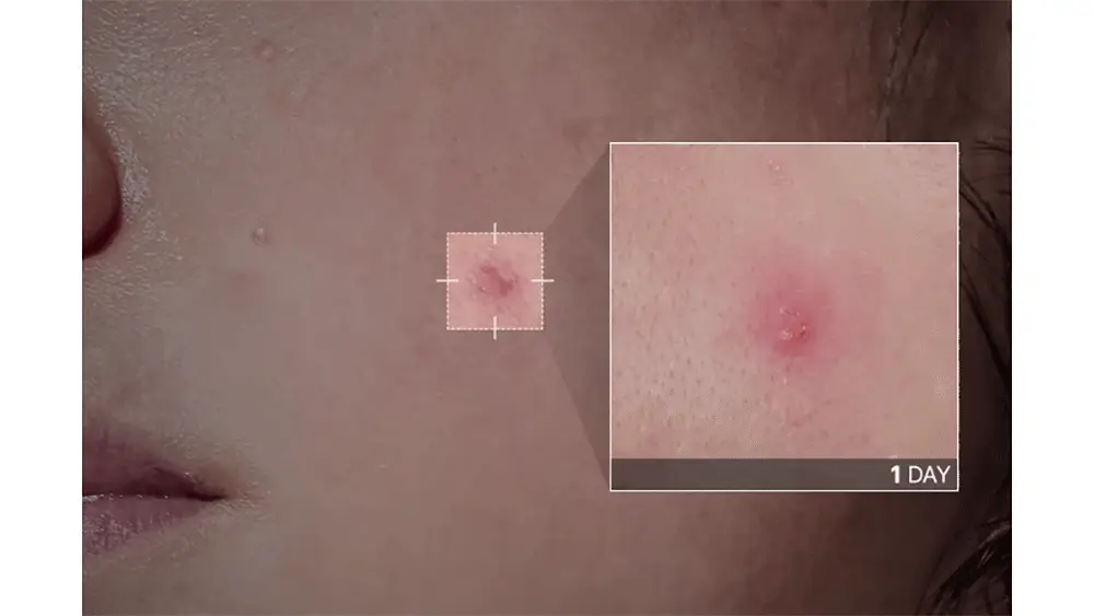 [트러블부위 진정케어] 피캄 센텔라 트러블 스팟 15ml 상세페이지 12